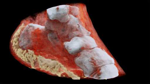 First-ever color X-ray on a human performed in New Zealand
