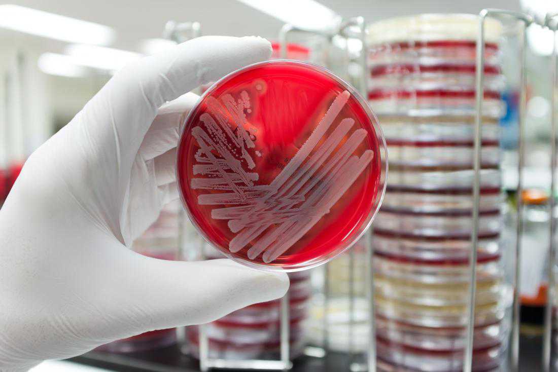 Antibiotic resistance: Breakthrough study offers solution