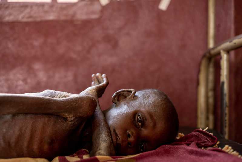 More starving children as CAR violence surges