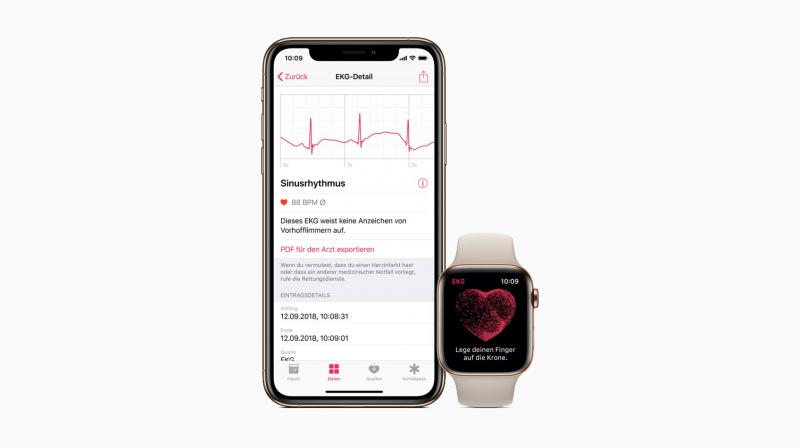 Apple Watch Series 4:  ECG app, irregular rhythm notification rolls out
