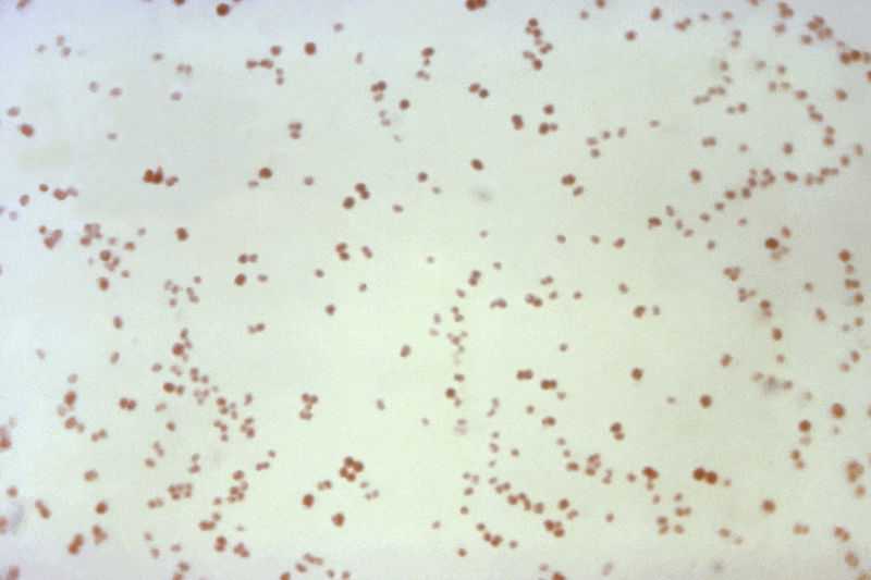 U.S. superbug infections rising, but deaths falling