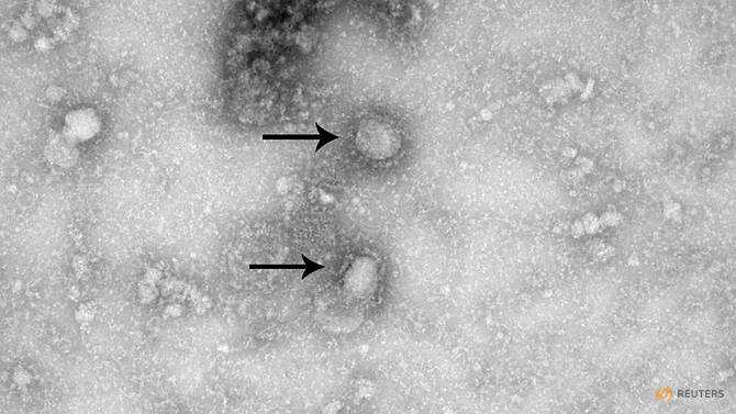 New study places Wuhan virus incubation period at around 5 days