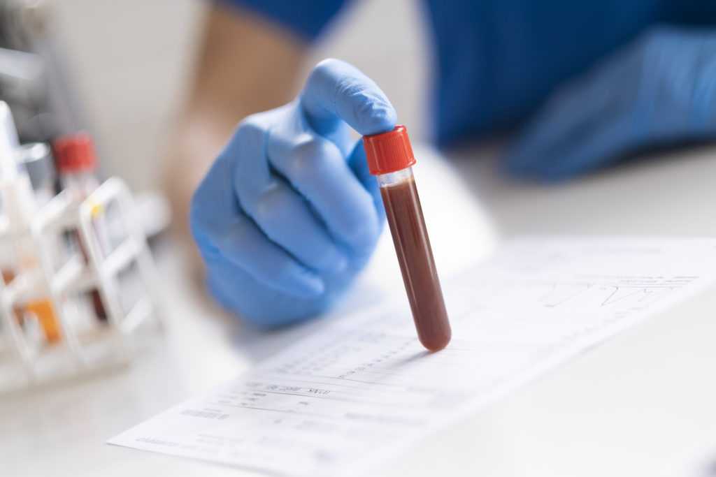 Is there a connection between blood infections and colorectal cancer?