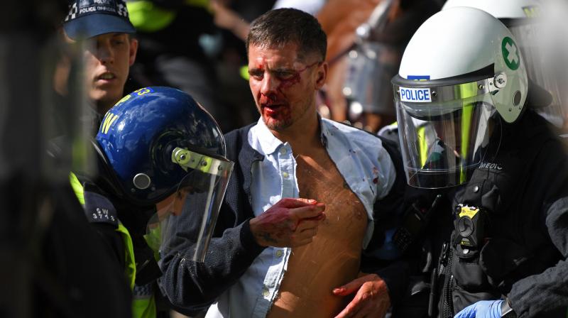 Far-proper protesters cause mayhem on London, Johnson condemns ‘racist thuggery’