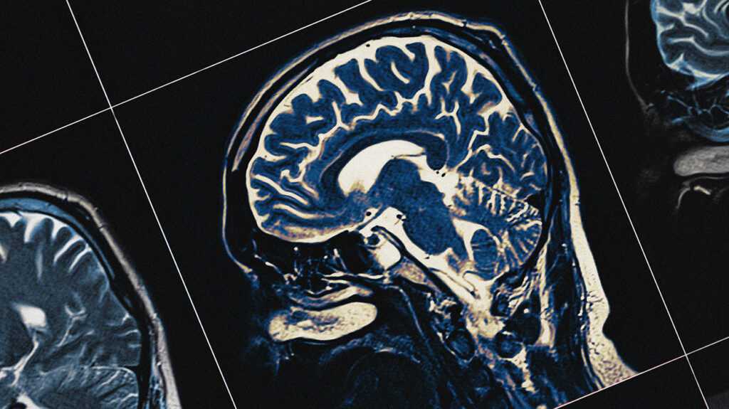 Brain areas found where serotonin boosts patience, impulse control