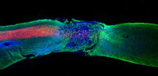 New class of drug reverses paralysis in mice