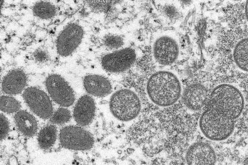 Scientists baffled by monkeypox cases in Europe, U.S.
