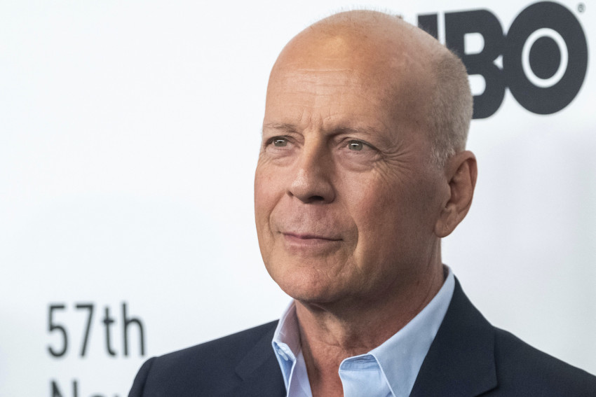 How frontotemporal dementia, the syndrome affecting Bruce Willis, changes the brain