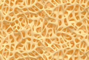 Osteoporosis: Could probiotics protect bone health?