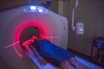 Dementia: Amyloid PET scans can improve diagnosis and care