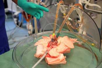 New transplant research aims to salvage infected donated organs