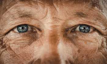 Could the eyes predict cardiovascular risk?