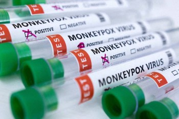 UK scientists given £2m to tackle global monkeypox outbreak