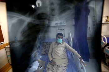 WHO reports increase in TB deaths during pandemic