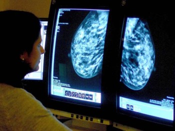 Arab Health: Early screening 'best weapon' in fight against cancer