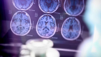 Government to launch $300M Alzheimer’s research database